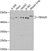 Thromboxane A2 Receptor Antibody - Western blot analysis of extracts of various cell lines using TBXA2R Polyclonal Antibody at dilution of 1:1000.