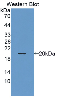 THRSP Antibody - Western blot of THRSP antibody.