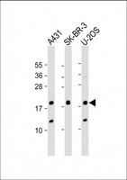 THRSP Antibody - All lanes: Anti-THRSP Antibody (N-Term) at 1:2000 dilution. Lane 1: A431 whole cell lysate. Lane 2: SK-BR-3 whole cell lysate. Lane 3: U-2OS whole cell lysate Lysates/proteins at 20 ug per lane. Secondary Goat Anti-Rabbit IgG, (H+L), Peroxidase conjugated at 1:10000 dilution. Predicted band size: 17 kDa. Blocking/Dilution buffer: 5% NFDM/TBST.