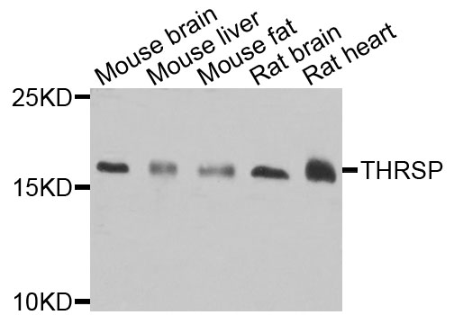 THRSP Antibody - Western blot analysis of extracts of various cells.