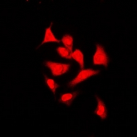 THRSP Antibody - Immunofluorescent analysis of Spot 14 staining in U2OS cells. Formalin-fixed cells were permeabilized with 0.1% Triton X-100 in TBS for 5-10 minutes and blocked with 3% BSA-PBS for 30 minutes at room temperature. Cells were probed with the primary antibody in 3% BSA-PBS and incubated overnight at 4 deg C in a humidified chamber. Cells were washed with PBST and incubated with a DyLight 594-conjugated secondary antibody (red) in PBS at room temperature in the dark.