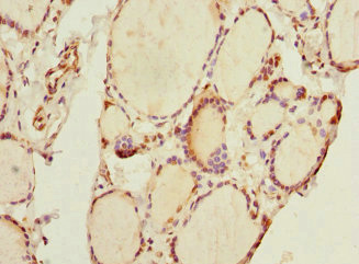 THRSP Antibody - Immunohistochemistry of paraffin-embedded human thyroid tissue at dilution 1:100