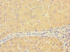 THRSP Antibody - Immunohistochemistry of paraffin-embedded human liver tissue at dilution 1:100