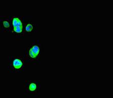 THRSP Antibody - Immunofluorescent analysis of MCF7 cells diluted at 1:100 and Alexa Fluor 488-congugated AffiniPure Goat Anti-Rabbit IgG(H+L)