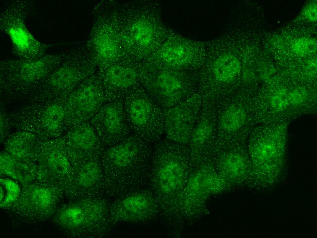 THRSP Antibody - Immunofluorescence staining of THRSP in A431 cells. Cells were fixed with 4% PFA, permeabilzed with 0.1% Triton X-100 in PBS, blocked with 10% serum, and incubated with rabbit anti-Human THRSP polyclonal antibody (dilution ratio 1:100) at 4°C overnight. Then cells were stained with the Alexa Fluor 488-conjugated Goat Anti-rabbit IgG secondary antibody (green). Positive staining was localized to Nucleus and Cytoplasm.