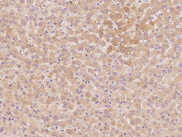 THRSP Antibody - Immunochemical staining of human THRSP in human liver with rabbit polyclonal antibody at 1:500 dilution, formalin-fixed paraffin embedded sections.