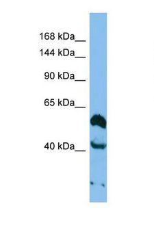 THSD1 / TMTSP Antibody - Western blot of Human A549 . THSD1 antibody dilution 1.0 ug/ml.  This image was taken for the unconjugated form of this product. Other forms have not been tested.
