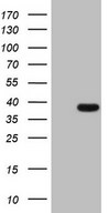THTPA Antibody - HEK293T cells were transfected with the pCMV6-ENTRY control (Left lane) or pCMV6-ENTRY THTPA (Right lane) cDNA for 48 hrs and lysed. Equivalent amounts of cell lysates (5 ug per lane) were separated by SDS-PAGE and immunoblotted with anti-THTPA.