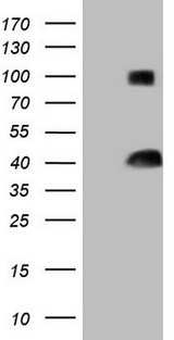 THTPA Antibody - HEK293T cells were transfected with the pCMV6-ENTRY control (Left lane) or pCMV6-ENTRY THTPA (Right lane) cDNA for 48 hrs and lysed. Equivalent amounts of cell lysates (5 ug per lane) were separated by SDS-PAGE and immunoblotted with anti-THTPA (1:2000).