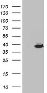 THTPA Antibody - HEK293T cells were transfected with the pCMV6-ENTRY control. (Left lane) or pCMV6-ENTRY THTPA. (Right lane) cDNA for 48 hrs and lysed. Equivalent amounts of cell lysates. (5 ug per lane) were separated by SDS-PAGE and immunoblotted with anti-THTPA.