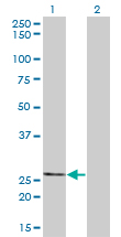THTPA Antibody - Western blot of THTPA expression in transfected 293T cell line by THTPA monoclonal antibody (M01), clone 3F6.