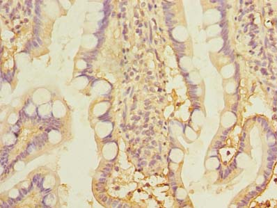 THTPA Antibody - Immunohistochemistry of paraffin-embedded human small intestine tissue using antibody at dilution of 1:100.