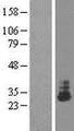 THTPA Protein - Western validation with an anti-DDK antibody * L: Control HEK293 lysate R: Over-expression lysate