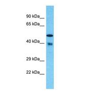 THUMPD1 Antibody - Western blot of Human MCF7. THUMPD1 antibody dilution 1.0 ug/ml.  This image was taken for the unconjugated form of this product. Other forms have not been tested.
