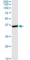 THUMPD1 Antibody - THUMPD1 monoclonal antibody (M01), clone 4A11. Western blot of THUMPD1 expression in human kidney.