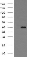 THUMPD1 Antibody - HEK293T cells were transfected with the pCMV6-ENTRY control (Left lane) or pCMV6-ENTRY THUMPD1 (Right lane) cDNA for 48 hrs and lysed. Equivalent amounts of cell lysates (5 ug per lane) were separated by SDS-PAGE and immunoblotted with anti-THUMPD1.