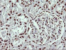 THUMPD1 Antibody - IHC of paraffin-embedded Human Kidney tissue using anti-THUMPD1 mouse monoclonal antibody.