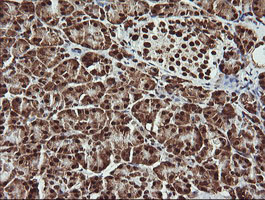 THUMPD1 Antibody - IHC of paraffin-embedded Human pancreas tissue using anti-THUMPD1 mouse monoclonal antibody.