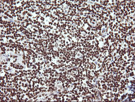 THUMPD1 Antibody - IHC of paraffin-embedded Human tonsil using anti-THUMPD1 mouse monoclonal antibody.