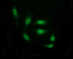 THUMPD1 Antibody - Immunofluorescent staining of HeLa cells using anti-THUMPD1 mouse monoclonal antibody.