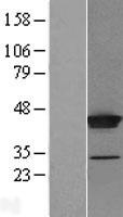 THUMPD1 Protein - Western validation with an anti-DDK antibody * L: Control HEK293 lysate R: Over-expression lysate