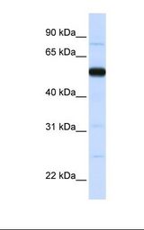 THUMPD2 Antibody - Placenta lysate. Antibody concentration: 1.0 ug/ml. Gel concentration: 12%.  This image was taken for the unconjugated form of this product. Other forms have not been tested.