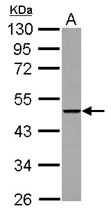 THUMPD2 Antibody - Sample (30 ug of whole cell lysate) A: A431 10% SDS PAGE THUMPD2 antibody diluted at 1:5000