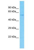 THUMPD3 Antibody - THUMPD3 antibody Western Blot of 293T. Antibody dilution: 1 ug/ml.  This image was taken for the unconjugated form of this product. Other forms have not been tested.