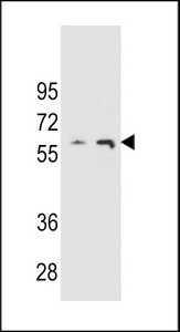 THUMPD3 Antibody - THUM3 Antibody western blot of A2058 and A375 cell line lysates (35 ug/lane). The THUM3 Antibody antibody detected the THUM3 Antibody protein (arrow).