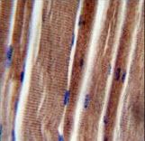 THUMPD3 Antibody - THUM3 Antibody immunohistochemistry of formalin-fixed and paraffin-embedded human skeletal muscle followed by peroxidase-conjugated secondary antibody and DAB staining.