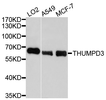THUMPD3 Antibody - Western blot analysis of extracts of various cell lines, using THUMPD3 antibody at 1:1000 dilution. The secondary antibody used was an HRP Goat Anti-Rabbit IgG (H+L) at 1:10000 dilution. Lysates were loaded 25ug per lane and 3% nonfat dry milk in TBST was used for blocking. An ECL Kit was used for detection and the exposure time was 90s.