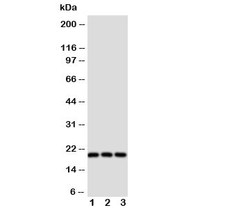 THY1 / CD90 Antibody - Western blot testing of Thy1 antibody and Lane 1: rat brain; 2: rat liver; 3: rat thymus tissue lysate