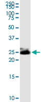 THY1 / CD90 Antibody - THY1 monoclonal antibody (M01), clone 3F9. Western Blot analysis of THY1 expression in IMR-32.