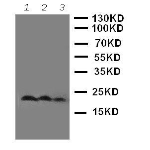 THY1 / CD90 Antibody - WB of THY1 / CD90 antibody. Lane 1: Rat Brain Tissue Lysate. Lane 2: Rat Liver Tissue Lysate. Lane 3: Rat Thymus Tissue Lysate.