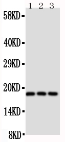 THY1 / CD90 Antibody - Anti-CD90/Thy1 antibody, Western blotting Lane 1: Rat Brain Tissue LysateLane 2: Rat Liver Tissue LysateLane 3: Rat Thymus Tissue Lysate