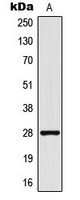 THY1 / CD90 Antibody - Western blot analysis of CD90 expression in MCF7 (A) whole cell lysates.