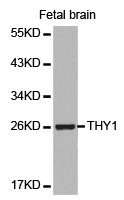 THY1 / CD90 Antibody - Western blot of extracts of fetal brain cell lines, using THY1 antibody.