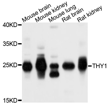 THY1 / CD90 Antibody - Western blot analysis of extracts of exosome from various cells.