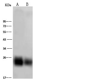 THY1 / CD90 Antibody - Anti-THY1 rabbit polyclonal antibody at 1:500 dilution. Lane A: Brain(mouse) Whole Cell Lysate. Lane B: kidney(mouse) Whole Cell Lysate. Lysates/proteins at 30 ug per lane. Secondary: Goat Anti-Rabbit IgG (H+L)/HRP at 1/10000 dilution. Developed using the ECL technique. Performed under reducing conditions. Predicted band size: 18 kDa. Observed band size: 23 kDa.