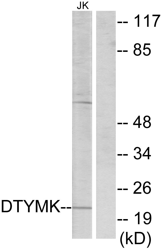 Thymidylate Kinase Antibody - Western blot analysis of lysates from Jurkat cells, using DTYMK Antibody. The lane on the right is blocked with the synthesized peptide.