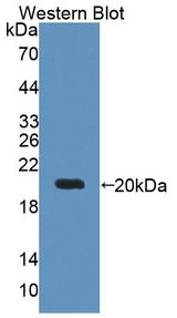 Thymidylate Kinase Antibody - Western Blot; Sample: Recombinant protein.
