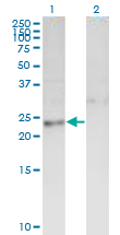 Thymidylate Kinase Antibody - Western Blot analysis of DTYMK expression in transfected 293T cell line by DTYMK monoclonal antibody (M01A), clone 2C2.Lane 1: DTYMK transfected lysate (Predicted MW: 23.8 KDa).Lane 2: Non-transfected lysate.