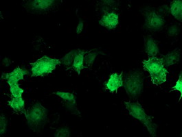 Thymidylate Kinase Antibody - Anti-DTYMK mouse monoclonal antibody immunofluorescent staining of COS7 cells transiently transfected by pCMV6-ENTRY DTYMK.