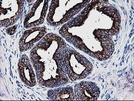 Thymidylate Kinase Antibody - IHC of paraffin-embedded Human prostate tissue using anti-DTYMK mouse monoclonal antibody.