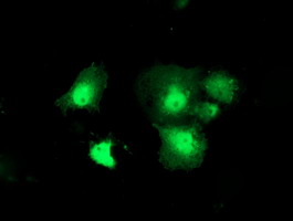 Thymidylate Kinase Antibody - Anti-DTYMK mouse monoclonal antibody immunofluorescent staining of COS7 cells transiently transfected by pCMV6-ENTRY DTYMK.