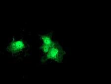 Thymidylate Kinase Antibody - Anti-DTYMK mouse monoclonal antibody immunofluorescent staining of COS7 cells transiently transfected by pCMV6-ENTRY DTYMK.