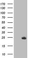 Thymidylate Kinase Antibody - HEK293T cells were transfected with the pCMV6-ENTRY control (Left lane) or pCMV6-ENTRY DTYMK (Right lane) cDNA for 48 hrs and lysed. Equivalent amounts of cell lysates (5 ug per lane) were separated by SDS-PAGE and immunoblotted with anti-DTYMK.