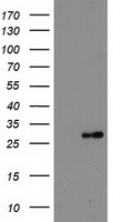 Thymidylate Kinase Antibody - HEK293T cells were transfected with the pCMV6-ENTRY control (Left lane) or pCMV6-ENTRY DTYMK (Right lane) cDNA for 48 hrs and lysed. Equivalent amounts of cell lysates (5 ug per lane) were separated by SDS-PAGE and immunoblotted with anti-DTYMK.