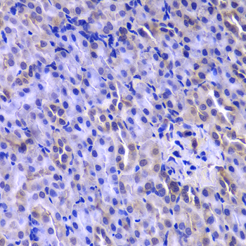 Thymidylate Kinase Antibody - Immunohistochemistry of paraffin-embedded Rat kidney tissue.