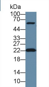 Thymidylate Kinase Antibody - Western Blot; Sample: Human Hela cell lysate; Primary Ab: 1µg/ml Rabbit Anti-Human DTYMK Antibody Second Ab: 0.2µg/mL HRP-Linked Caprine Anti-Rabbit IgG Polyclonal Antibody